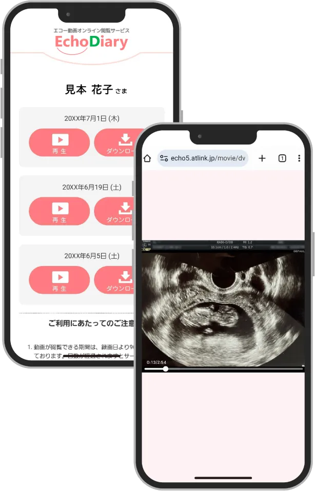 echodiary画面イメージ